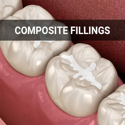 Visit our Composite Fillings page