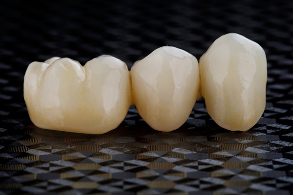 Tooth Replacement    : Why A Dentist May Recommend A Dental Bridge