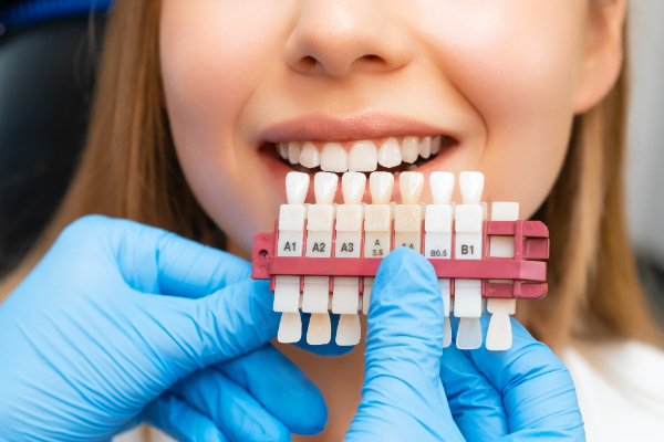 What To Ask Your Dentist About Getting Veneers