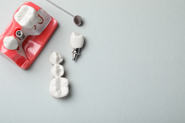 Dental Restorations From A Restorative Dentist
